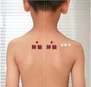 小兒推拿培訓小兒推拿手法應該注意哪些事項？